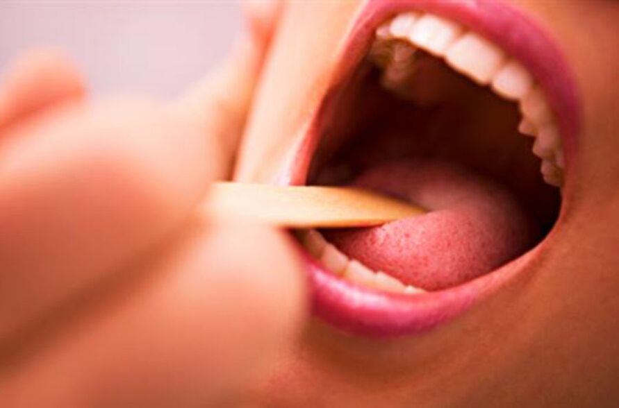 jenis parasit dina sungut manusa